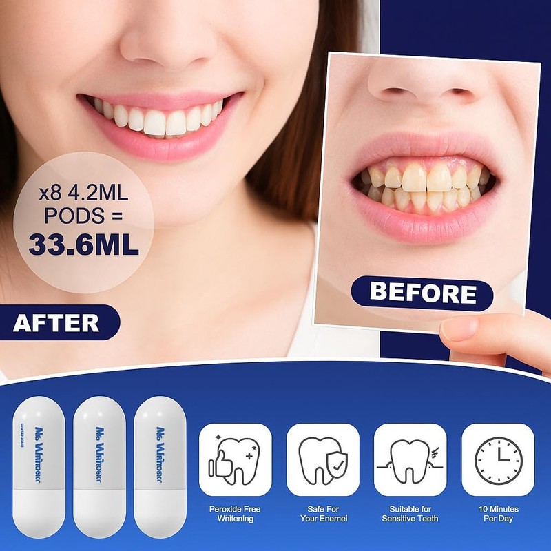 Mr.Whitener Teeth Whitening Refill Kit – 8 Gel Pods (33.6ml)