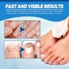 Ginger Nail Tratamiento Uñas Jengibre Soporte Cuidado Suero Crecimiento Aceite