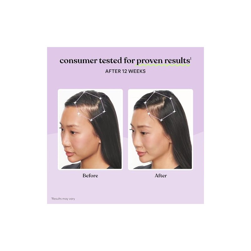 Lemme Suplemento para el crecimiento del cabello para mujeres, complejo
