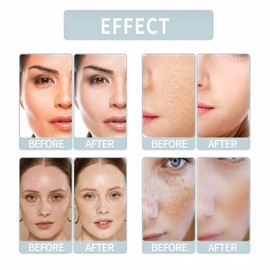 Total Package Serums,Hyaluronic Acid Serum,Hydrating Serum,Face Moisturisers,Collagen Ser-um for Face,Hyaluronic Acid Moisturiser,Anti Wrinkle Ser-um,Anti Aging Se-rum,Moist-uriser for Dry Skin Fac-e