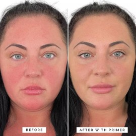 Elizabeth Mott Thank Me Later Face Primer w Niacinamide, Neutralize Uneven 30 g - Color Correcting