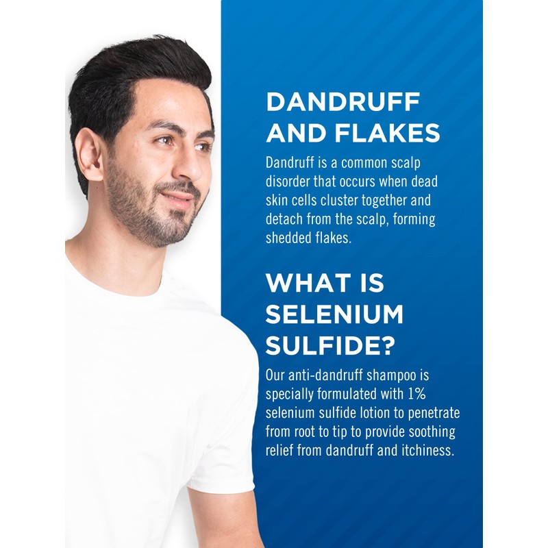 Selsun Blue Normal-Oily Hair Anti-Dandruff Shampoo, 300 mL, Helps Control