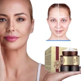 Crema Despigmentante De Manchas Paño Melasma Pecas Blanquea