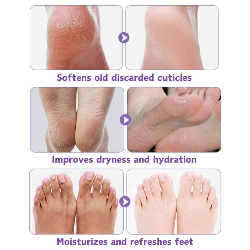 5 Pairs Foot Peel Mask for Hard Skin,Lavender Exfoliating Foot