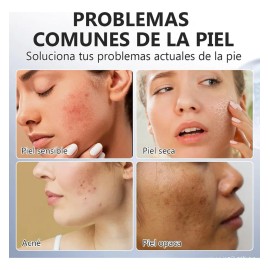 (paquete De 2 Frascos) Crema De cido Kjico Para Blanquear E Iluminar La Piel, Combate Las Pecas Y Un Tono Apagado, Mejora La Textura De La Piel Opaca 