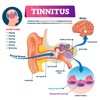 BoltSafe Tinnitus Relief Earplugs | Red Light Laser Therapy |