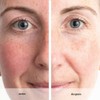 ANEW RENEWAL POWER SERUM 30 ml