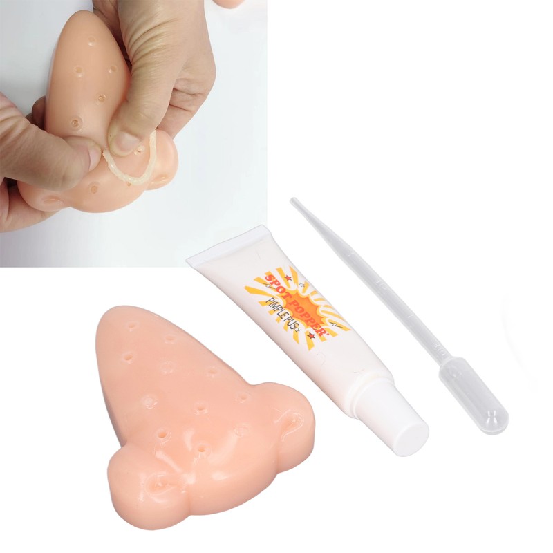 Pimples Blackhead Toys Stress Relief Relaxing Jokes Props TPE Squeeze