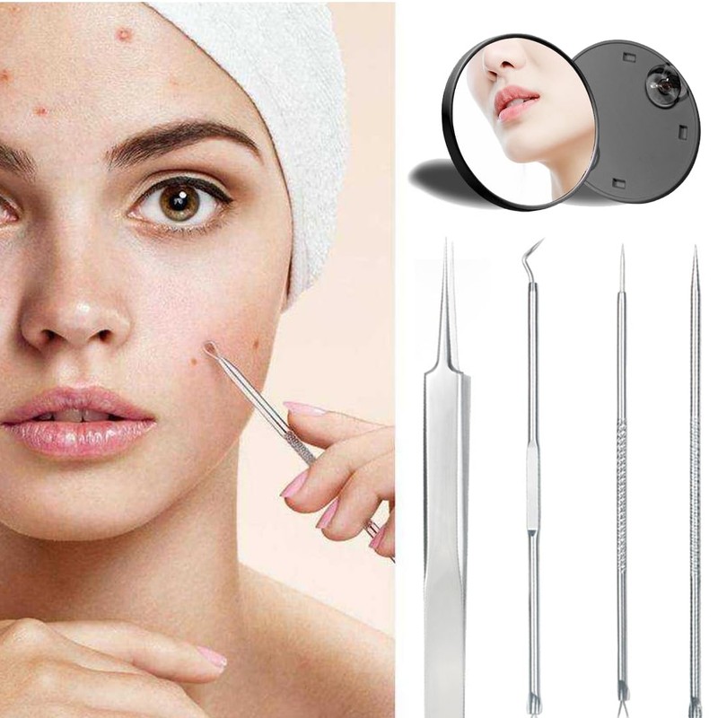 PEXIVOZ 4 Stück Mitesserentferner Komedonenquetscher Set，Mitesserentferner Komedonenquetscher Set, aus kleiner