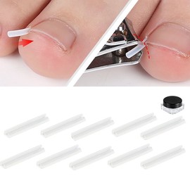 Ingrown Toenail Corrector Kit: Toe Band & Wire Tips (10 Pcs) Ingrown Toenail Tips 10pcs 8ea