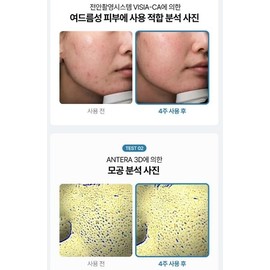 Mediorga Spicule Cream