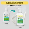 AmLactin Daily Nourish 5% Face & Body Lotion for Dry