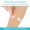 ViveCare Emergency Wound Closure Device Kit 4 Pcs - Adhesive