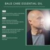 Cuidado Del Cuero Cabelludo 20 Ml
