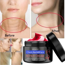 Eelhoe Crema Antiedad Para Rostro Cuello y Pecho Elimina Manchas Día Noche