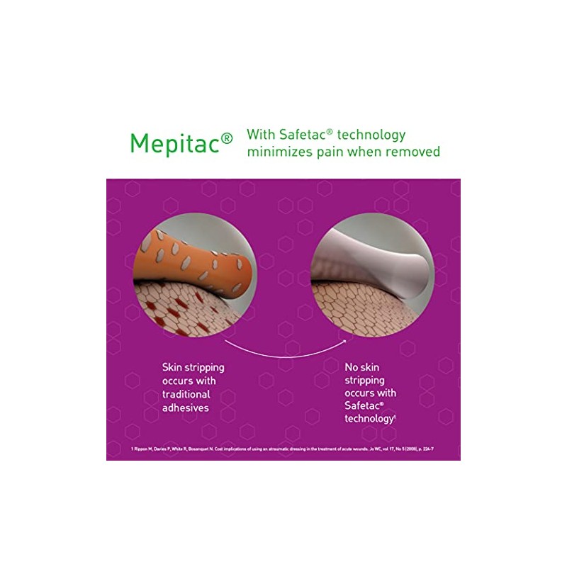Mepitac 298300 Soft Silicone Tape, 2 cm x 3 /0.8