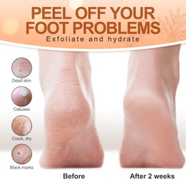 Foot Peel Mask (5 Pairs) - 3-in-1 Foot Peeling Mask + Foot Scrubber + Socks, Foot Care Kit for Cracked Heels, Callus Remover for Feet, Natural Exfoliating for Dead Skin