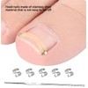KimDaro Ingrown Toenail Corrector, Stainless Steel Curved Toenail Straightener with