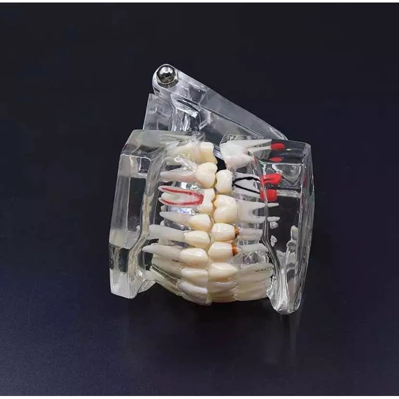 YouDental Tipodonto De Tratamientos Dentales