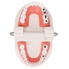 Dental Disease Caries Teeth Model Resin Simulation Teaching Prop Dental