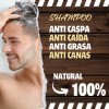 Skin Natural Shampoo Sólido Anti Caida Canas Caspa Grasa