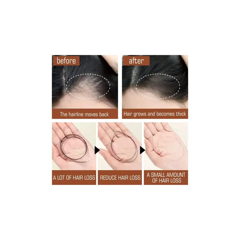 Aceite De Batana Para Cabello Aceite De Batana Crema Para
