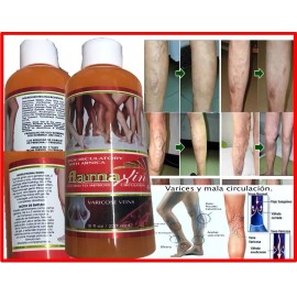 Herbal Ointment Varicose Veins Vasculitis Support Foot Care Cream leg gel cream
