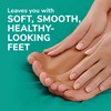 Dr. Scholl's Fast Acting Callus Remover Gel Kit, Hard Skin