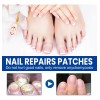 120 Parches Reparación Uñas Nails Hongos