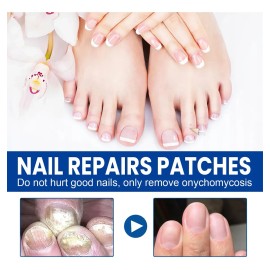 120 Parches Reparación Uñas Nails Hongos