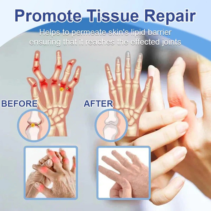 Crema Nutritiva Y Calmante Para Las Articulaciones