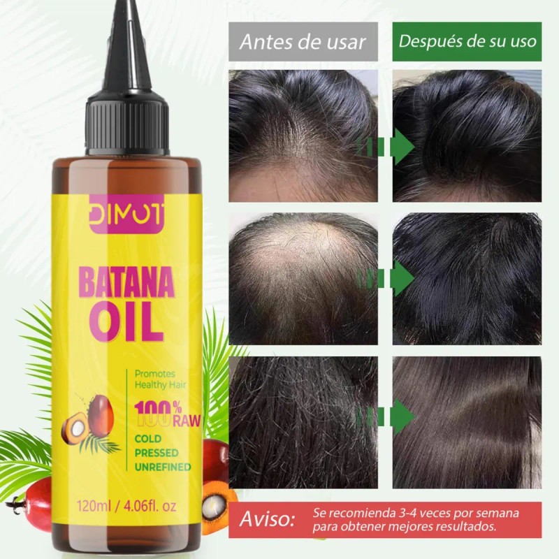 2p Aceite De Batana Orgnico Natural Crecimiento Del Cabello