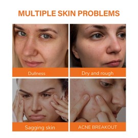 2025 New Kojic Acid Cream for Face, Moisturizing & Hydrating, 50g/1.76oz