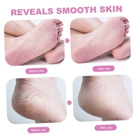 GLEAVI 2pcs Heel Grinder Professional Pedicure Tools Double- Sided Foot Peel Tool Foot Pedicure Tool Pedicure Rasp Manual Foot Rasp Heel Shaver Scraper File Crystal Set Abs