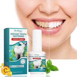 1/2/4pcs Dental Care Lacquer With Vitamin C Mint Gentle Cleaning Teeth Shiny Feeling Long Lasting Fresh Breath Full of Confidence Smile - Specification: 2pcs