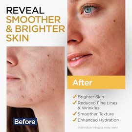 Suero de vitamina C para cara con células madre, ácido hialurónico, vitamina E, aloe vera para todo tipo de piel, suero facial antienvejecimiento, apo