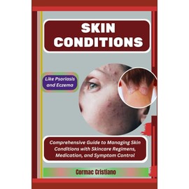 SKIN CONDITIONS: Like Psoriasis and Eczema: Comprehensive Guide to Managing Skin Conditions with Skincare Regimens, Medication, and Symptom Control