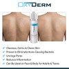 OxyDerm- Tratamiento limpiador con perxido de benzoilo al 10 elimina