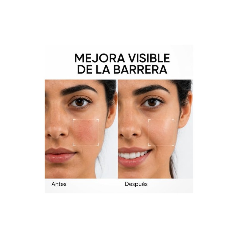 SKINTIFIC Gel Hidratante Facial 5X Ceramida Light 30g