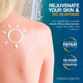 Epic Organicum After Sun Lotion | Sunburn Relief | Aloe Vera & Vitamin E Cream | Body Lotion & Face Moisturizer | Lotion for Dry Skin | Itchy Skin Relief | Moisturizer Face Cream | 8 oz