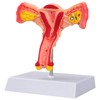 SimCoach Human Uterus and Ovary Anatomical Model, Female Reproductive Model