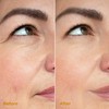 Miracle Retinol Moisturizer – 2.5% Active Retinol, Vitamin E &