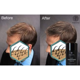 Fidentia Premium Pouring Hair Classic 40 g Refill Pack Dark Brown - Dark Brown