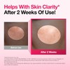 Lingtoolator Spot Correcting Serum / 10% Niacinamide+ 4% Tranexamic Acid,