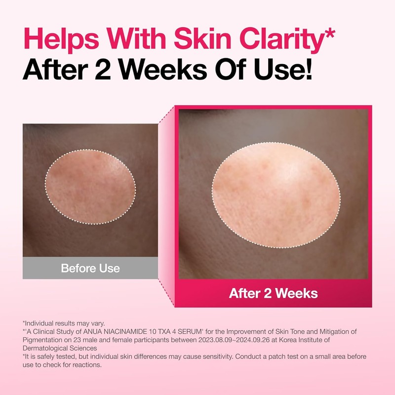 Lingtoolator Spot Correcting Serum / 10% Niacinamide+ 4% Tranexamic Acid,