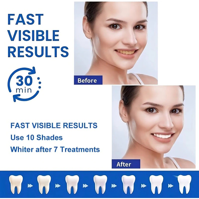 Tiras Blanqueadoras Dentales White Piezas Antideslizantes Higiene Bucal Dmtogeltd