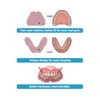 DENTUREWAY DIY Denture Kit with Impression(3 Sets of False Teeth),Do-It-Yourself