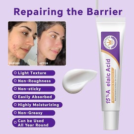 15% Acid Spot Cream,Acne Treatment Cream 20g,Fast Acting Spot Treatment for Face,Dark Spot Remover for Face,Reduces Blemishes & Breakouts, Gentle Skin Care Pimple Crea-m