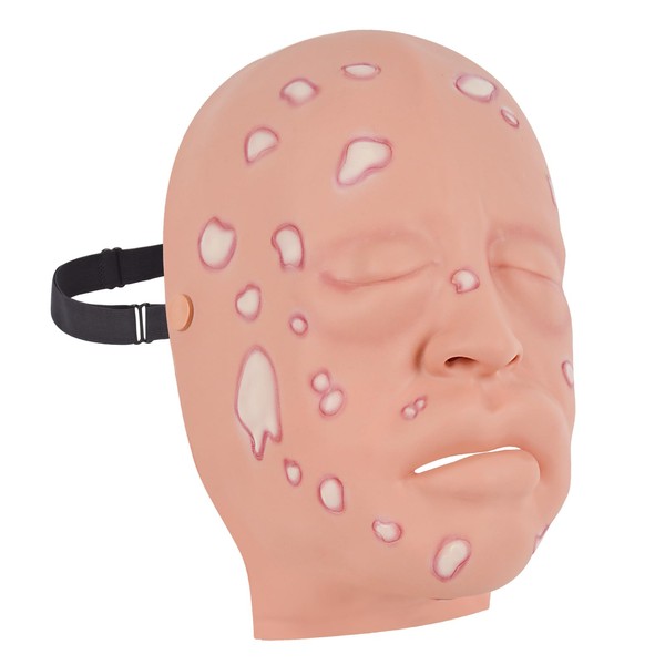 Simedutech Facial Trauma Model,Mustard Gas Face,Comprehensive Wearable Facial Pathology and