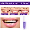 Purple Teeth Whitening Toothpaste Toothpaste 1 Piece White Teeth Whitening